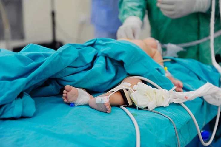 PAEDIATRIC SURGERY--------14