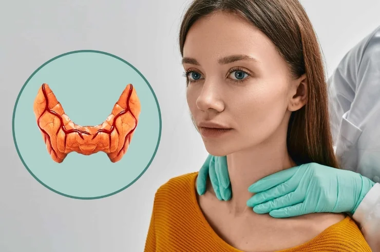 Thyroid Disorders
