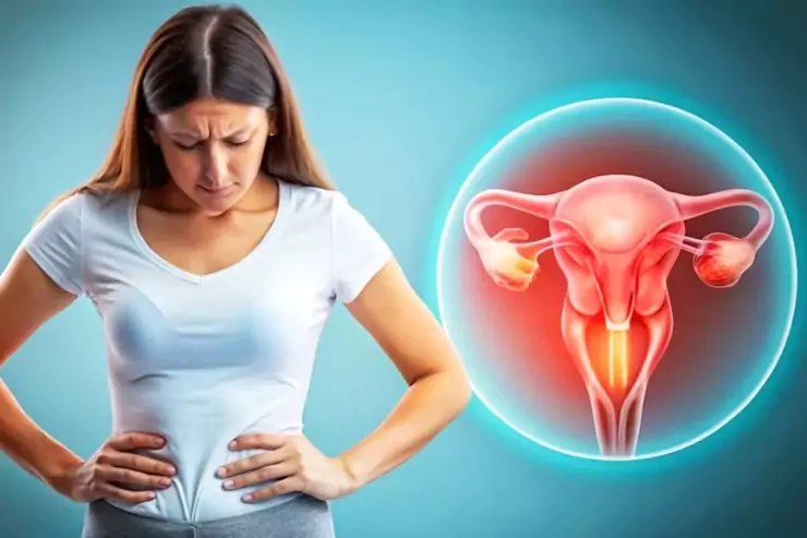 Polycystic Ovary Syndrome(pcos)